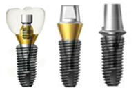 Implant Dentistry